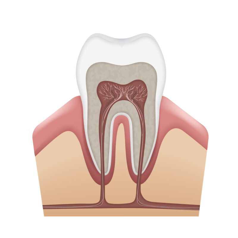 tratamento de canal dente denstista